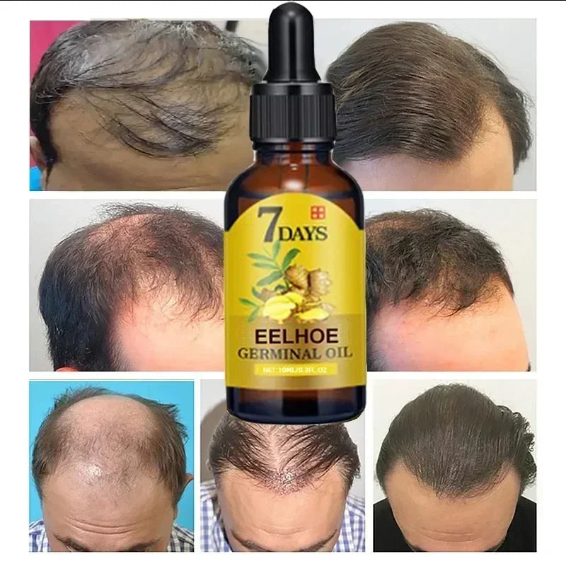 7 Day Fast Hair Growth Serum