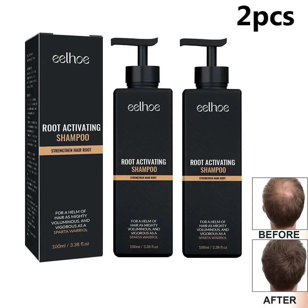 Anti Baldness Shampoo Thickening Root Activator Nourish Regrowth for Thinning Hair & Hair Loss