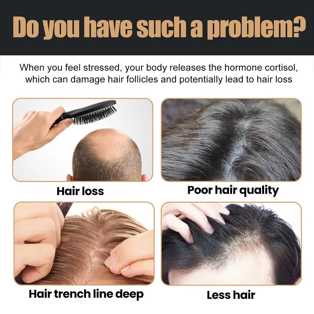 Anti Baldness Shampoo Thickening Root Activator Nourish Regrowth for Thinning Hair & Hair Loss