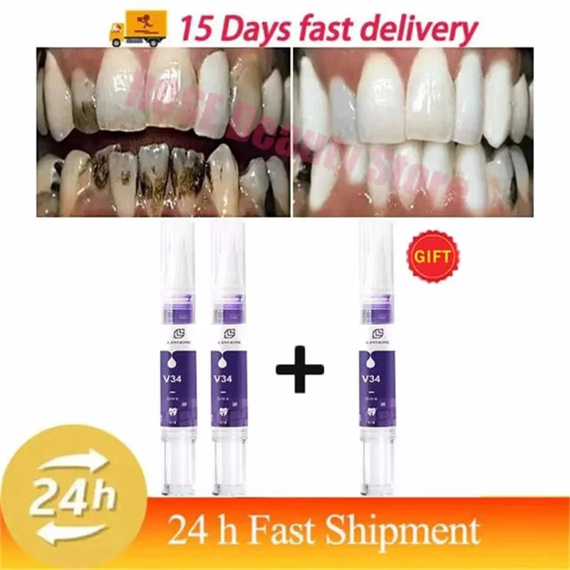 Magical Teeth Whitening Pen Removes Dental Plaque Coffee Stains Smoke Stains Freshens Breath