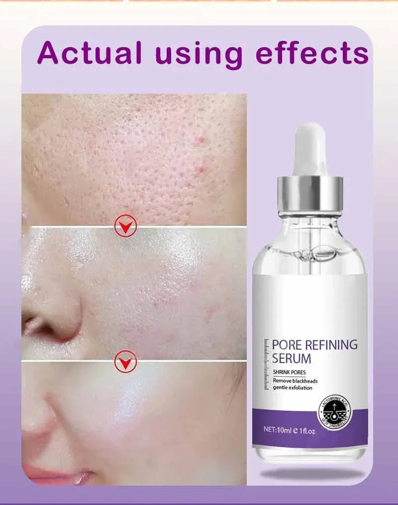 Skin Texture Pore Refining Resurfacing Brightening Facial Serum Retinol and Niacinamide Non-Comedogenic
