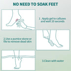 NAILPOP Extra Strength Callus Remover for Feet