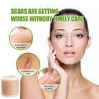 4X300CM Silicone Scar Patch Skin Repair Sheets Self-Adhesive Stretch Mark Tape Therapy Patch Burn Acne Scar  ﻿