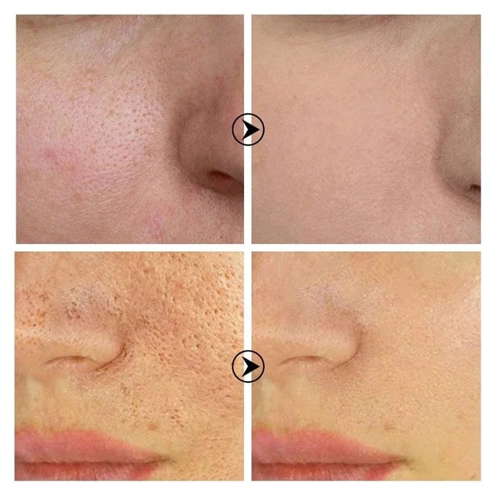 Skin Texture Pore Refining Resurfacing Brightening Facial Serum Retinol and Niacinamide Non-Comedogenic