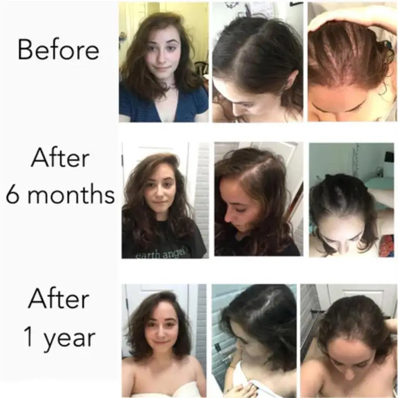 Fast Hair Growth Serum Men