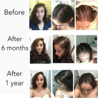 Fast Hair Growth Serum Men