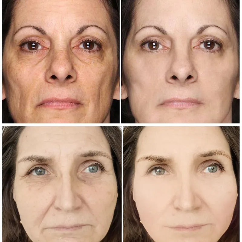 Retinol Wrinkle Remover Face Cream Firming Lifting Anti Aging Fade Fine Lines Moisturizing Whitening Korean