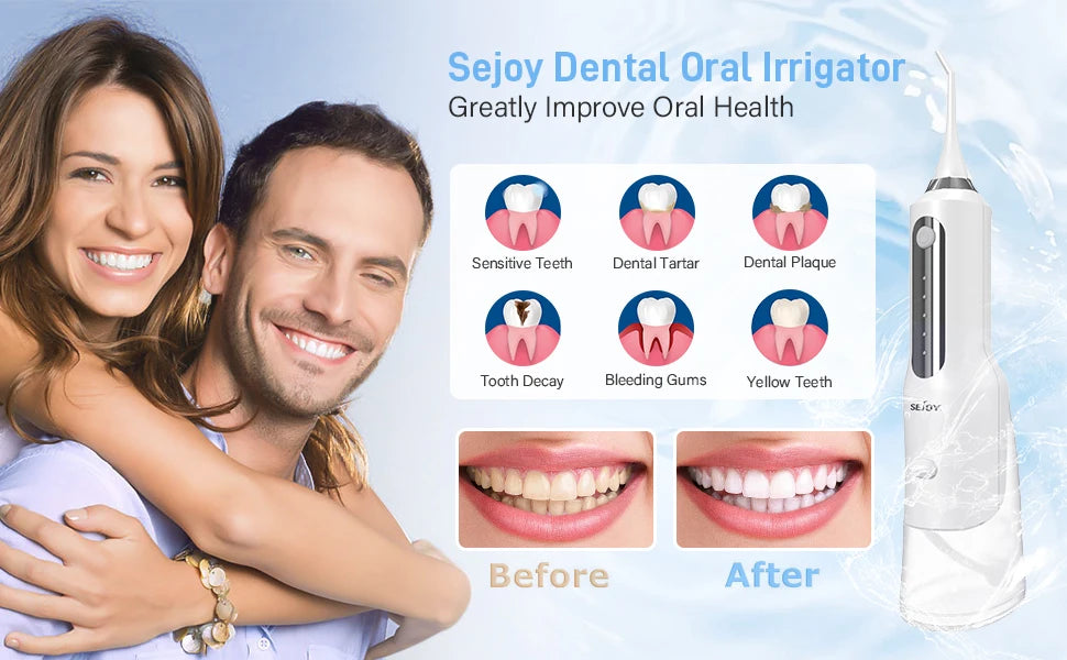 Sejoy Cordless Electric Water Flosser for Teeth Dental Portable Oral Irrigator Rechargeable