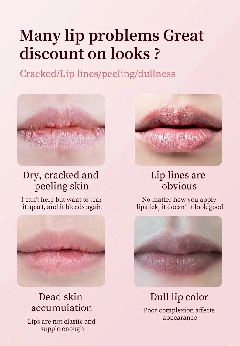 Lip Balm Lightening Pink Lipstick Exfoliating Fade Lip Lines Korean Cosmetics