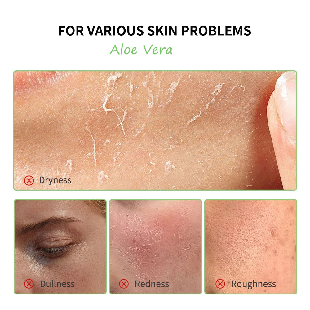 Multi-skin Care Aloe Vera Set Deep Moisturizing Nourishment Whitening Brightening Hydrating