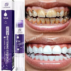 Magical Teeth Whitening Pen Removes Dental Plaque Coffee Stains Smoke Stains Freshens Breath