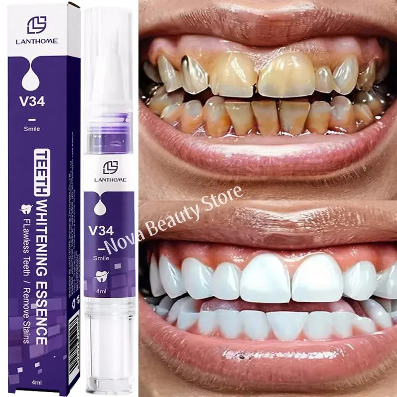 Magical Teeth Whitening Pen Removes Dental Plaque Coffee Stains Smoke Stains Freshens Breath