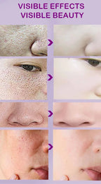 Skin Texture Pore Refining Resurfacing Brightening Facial Serum Retinol and Niacinamide Non-Comedogenic