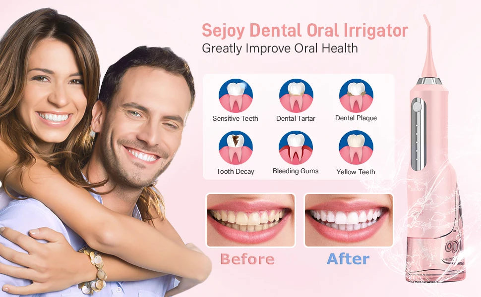 Sejoy Cordless Electric Water Flosser for Teeth Dental Portable Oral Irrigator Rechargeable