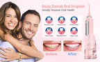 Sejoy Cordless Electric Water Flosser for Teeth Dental Portable Oral Irrigator Rechargeable