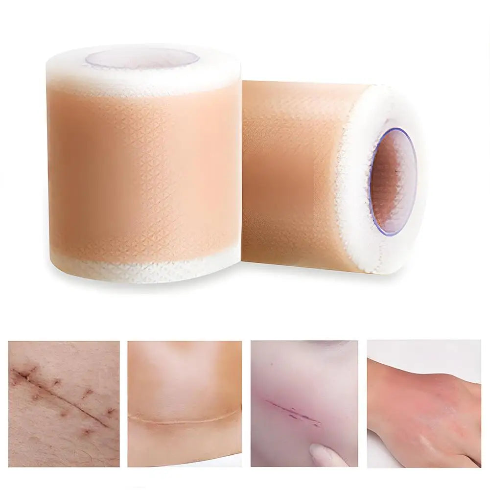4X300CM Silicone Scar Patch Skin Repair Sheets Self-Adhesive Stretch Mark Tape Therapy Patch Burn Acne Scar  ﻿