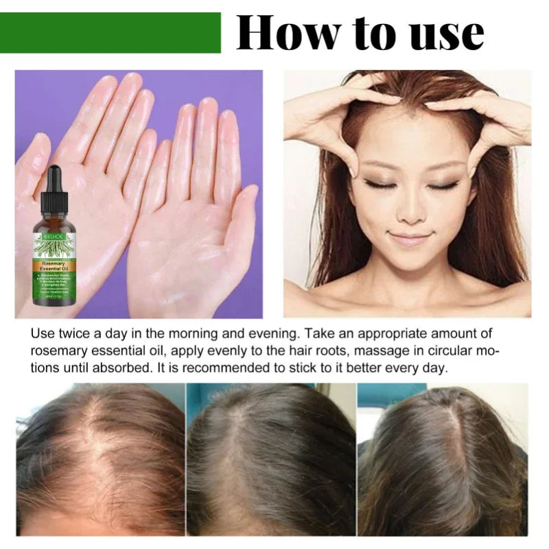 Rosemary Essential Oil Hair Growth 30ML Nourish Shiny Healthy