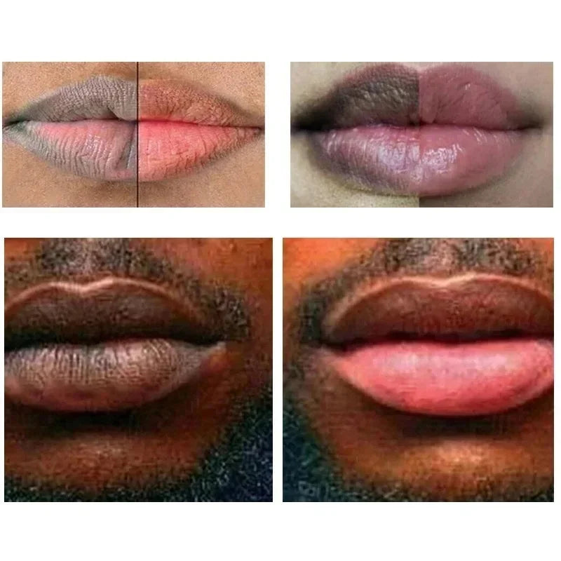 Lip Balm Lightening Pink Lipstick Exfoliating Fade Lip Lines Korean Cosmetics