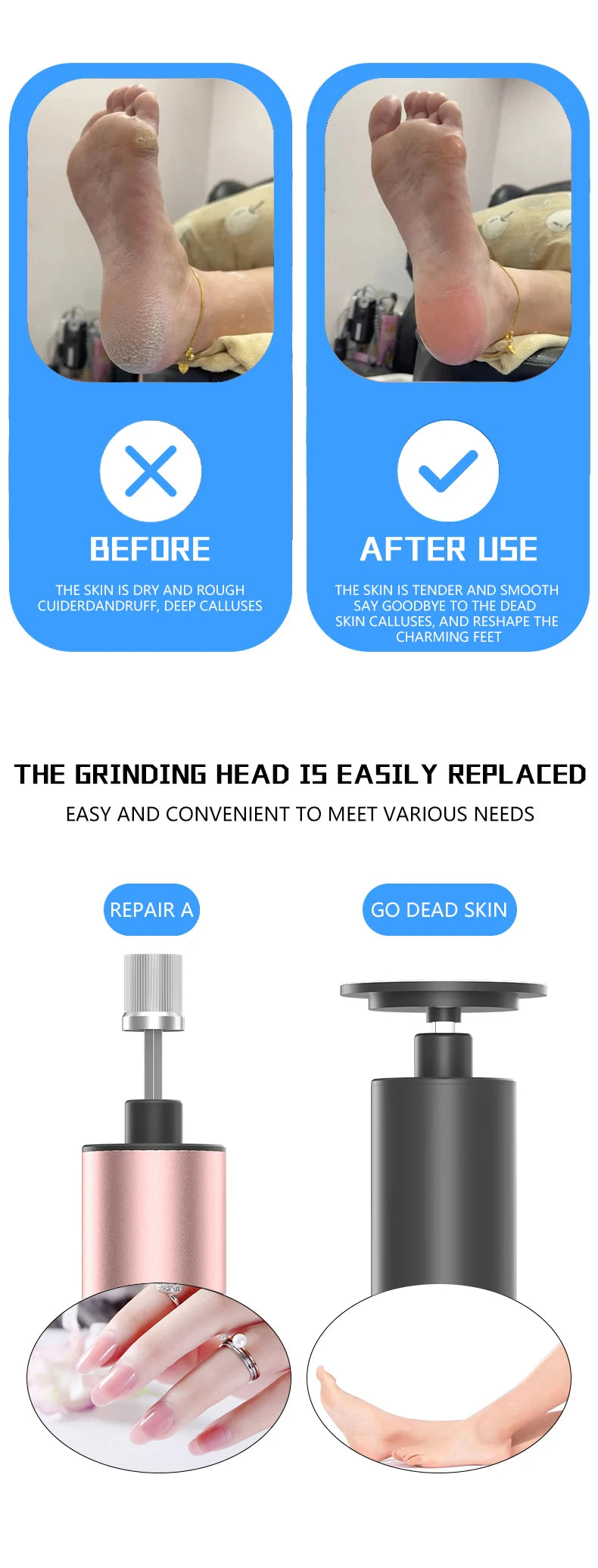 Electric Foot Callus Remover