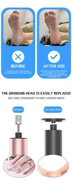 Electric Foot Callus Remover