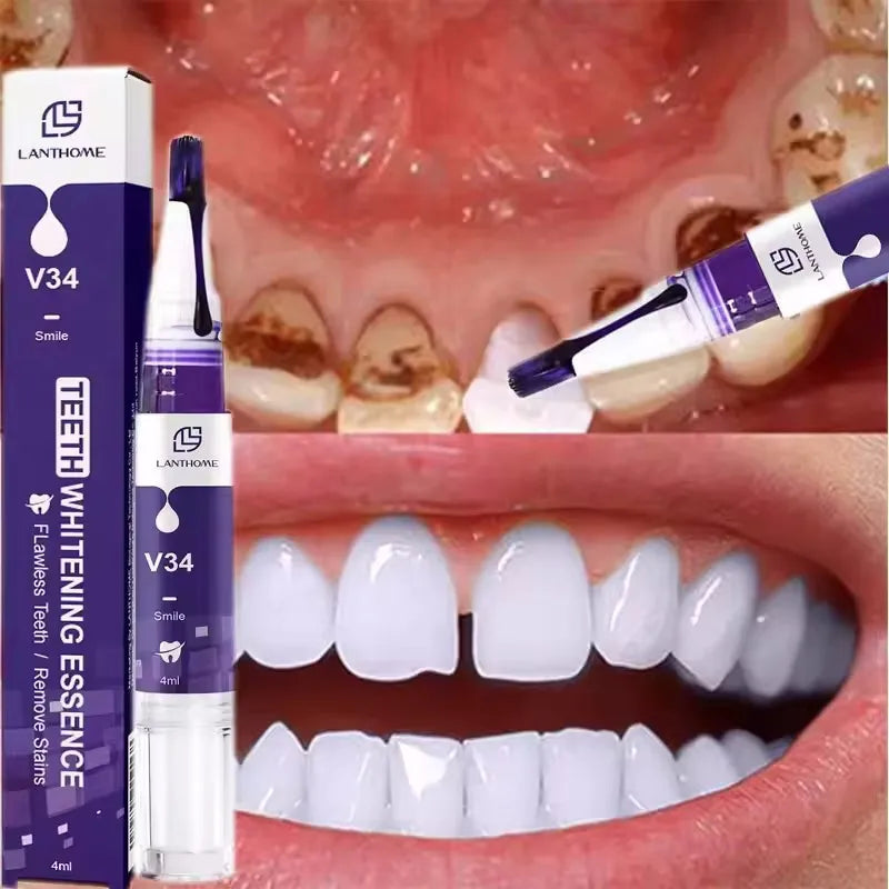 Magical Teeth Whitening Pen Removes Dental Plaque Coffee Stains Smoke Stains Freshens Breath