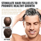 Anti Baldness Shampoo Thickening Root Activator Nourish Regrowth for Thinning Hair & Hair Loss