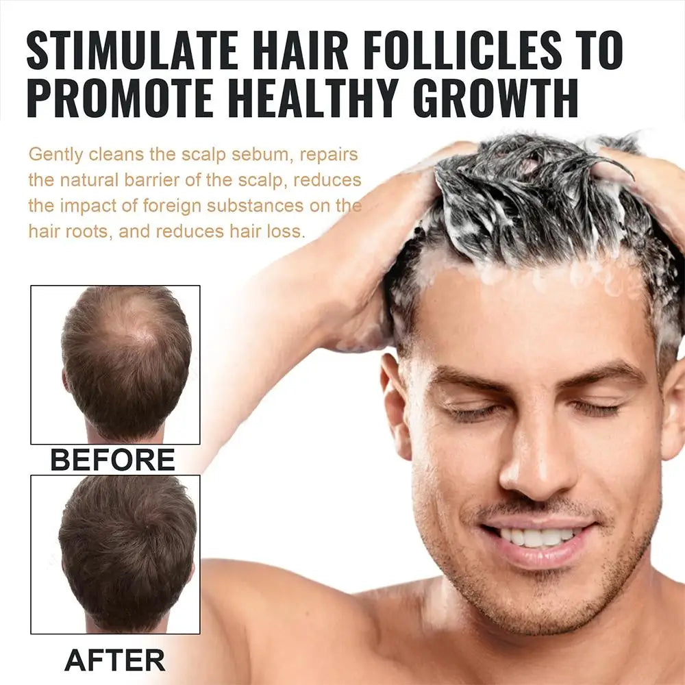 Anti Baldness Shampoo Thickening Root Activator Nourish Regrowth for Thinning Hair & Hair Loss