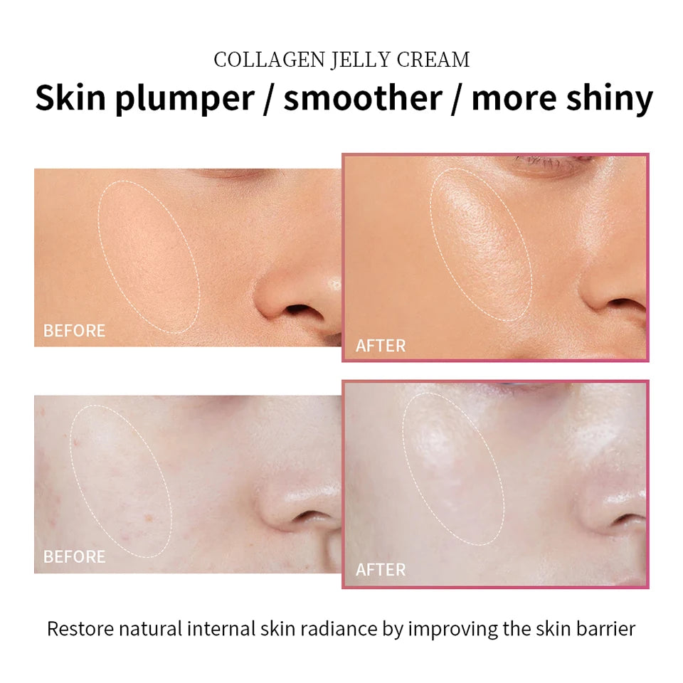 Moisturizing Jelly Cream Niacinamide Hydrolyzed Collagen Tightening Soothing Anti-Aging Firmness Hydration Skincare
