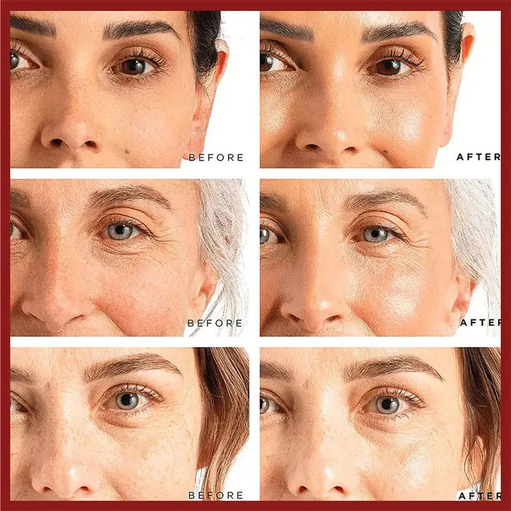 Retinol Wrinkle Remover Face Cream Firming Lifting Anti Aging Fade Fine Lines Moisturizing Whitening Korean