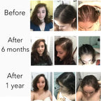 Fast Hair Growth Serum Men