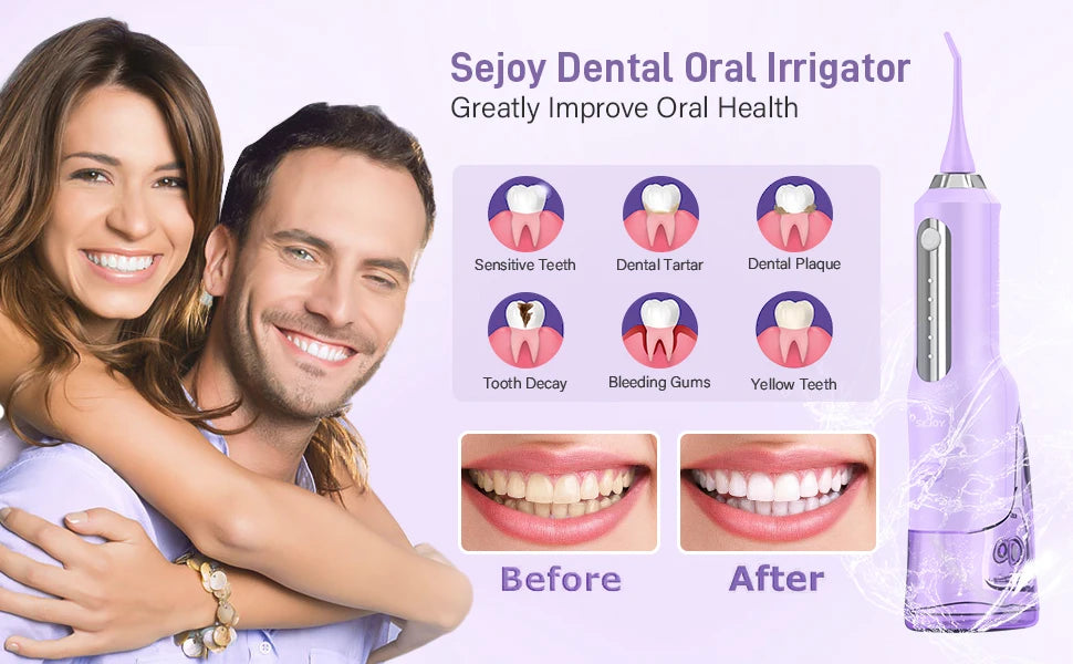 Sejoy Cordless Electric Water Flosser for Teeth Dental Portable Oral Irrigator Rechargeable