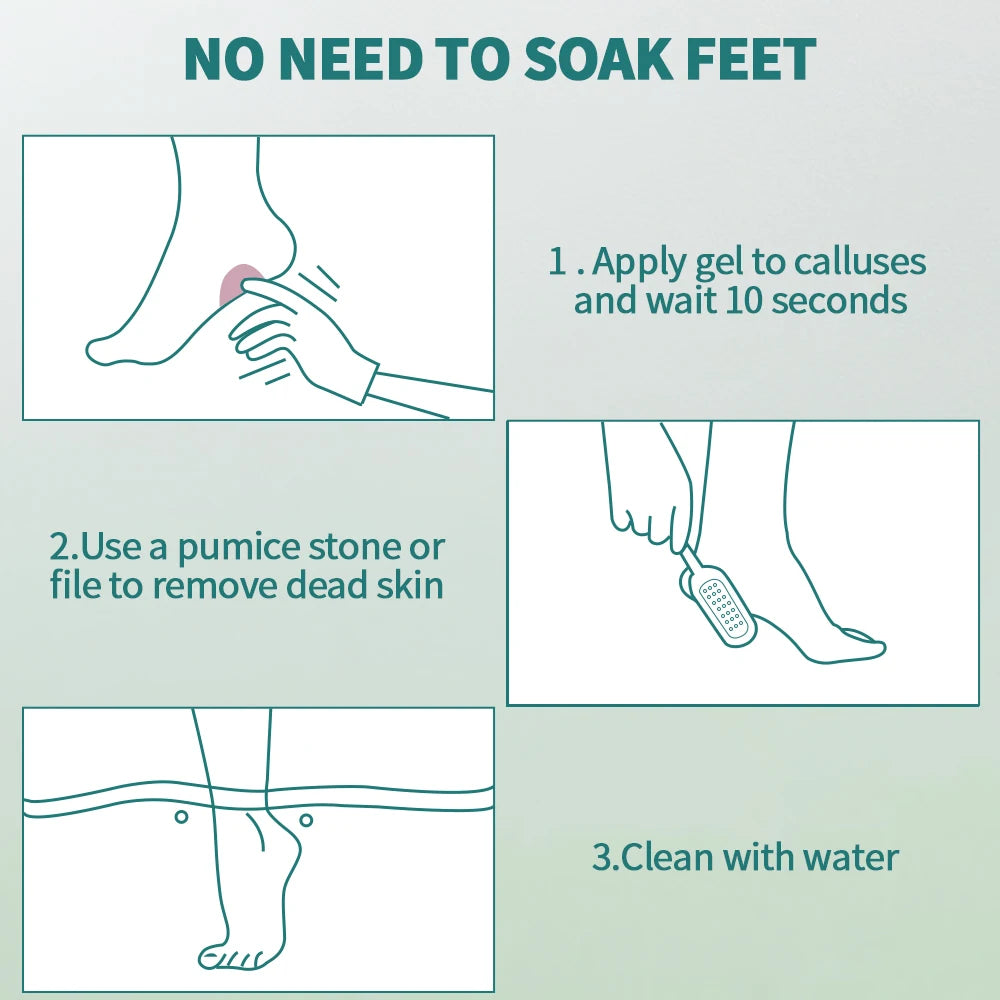 NAILPOP Extra Strength Callus Remover for Feet