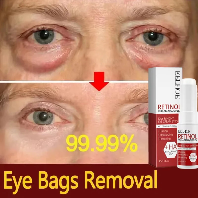 Retinol Eye Cream Collagen Stick Hyaluronic Acid