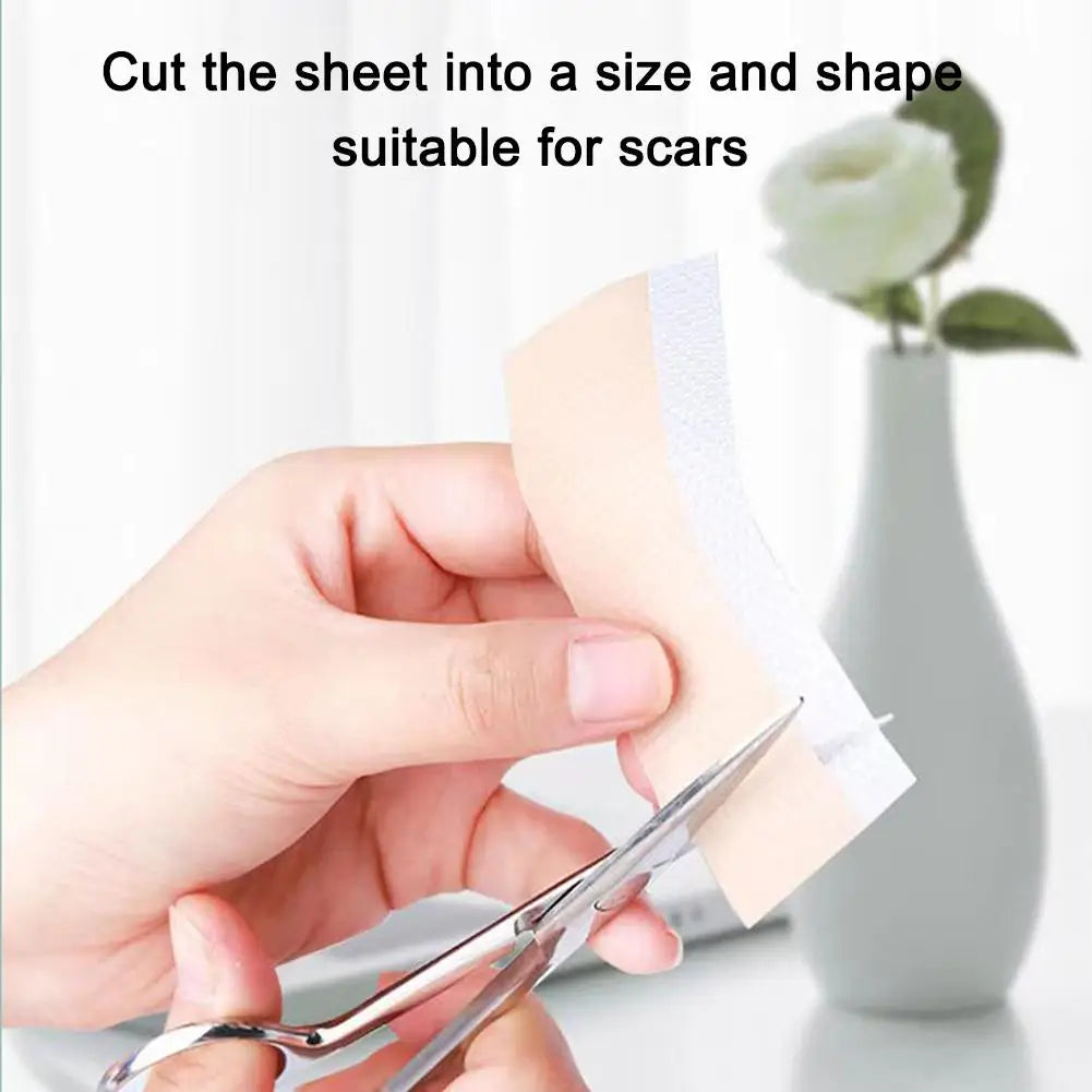 4X300CM Silicone Scar Patch Skin Repair Sheets Self-Adhesive Stretch Mark Tape Therapy Patch Burn Acne Scar  ﻿