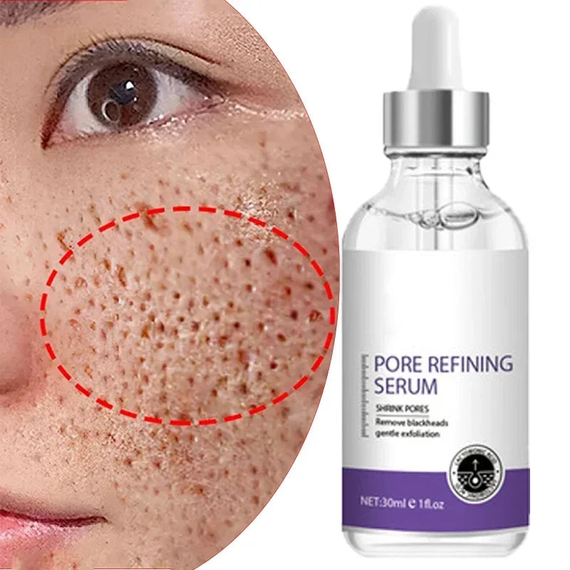 Skin Texture Pore Refining Resurfacing Brightening Facial Serum Retinol and Niacinamide Non-Comedogenic