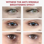 Retinol Eye Cream Collagen Stick Hyaluronic Acid