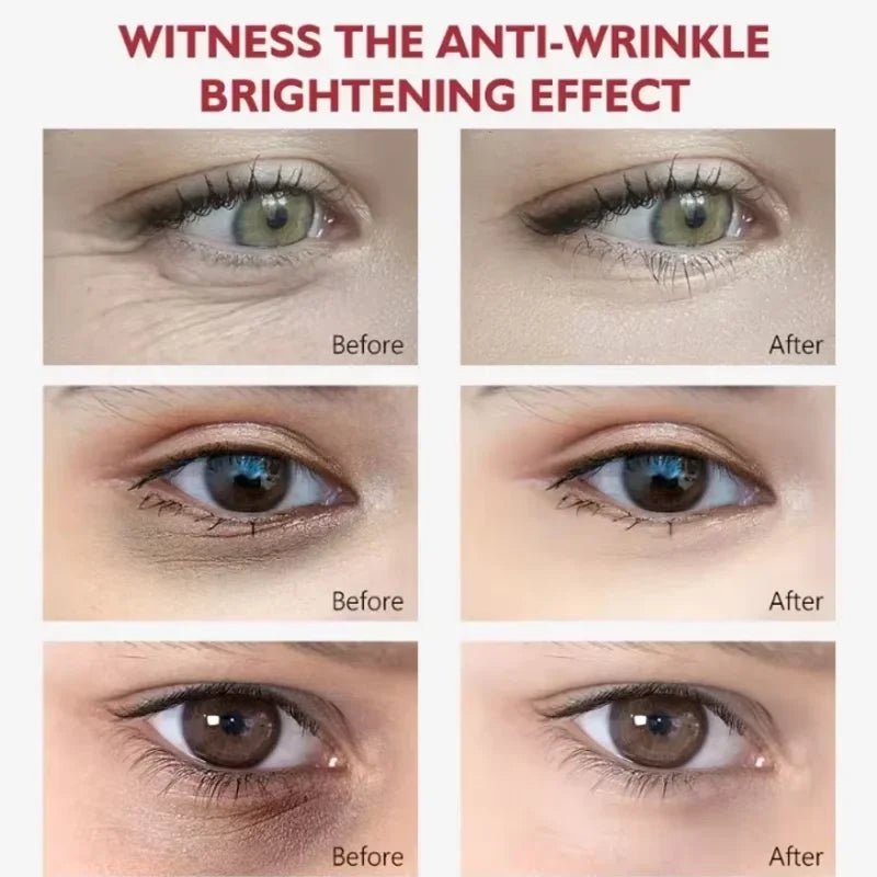 Retinol Eye Cream Collagen Stick Hyaluronic Acid