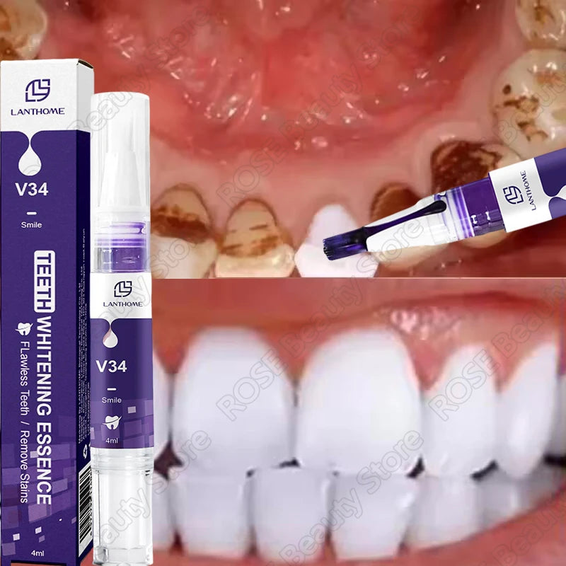 Purple Whitening Teeth Stickers 14 Pairs