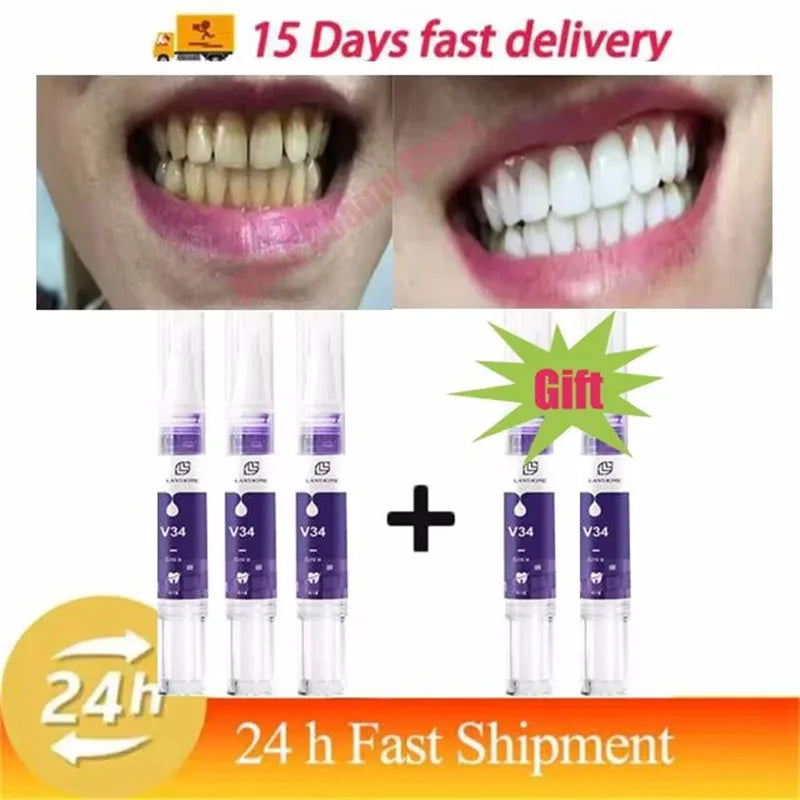 Magical Teeth Whitening Pen Removes Dental Plaque Coffee Stains Smoke Stains Freshens Breath