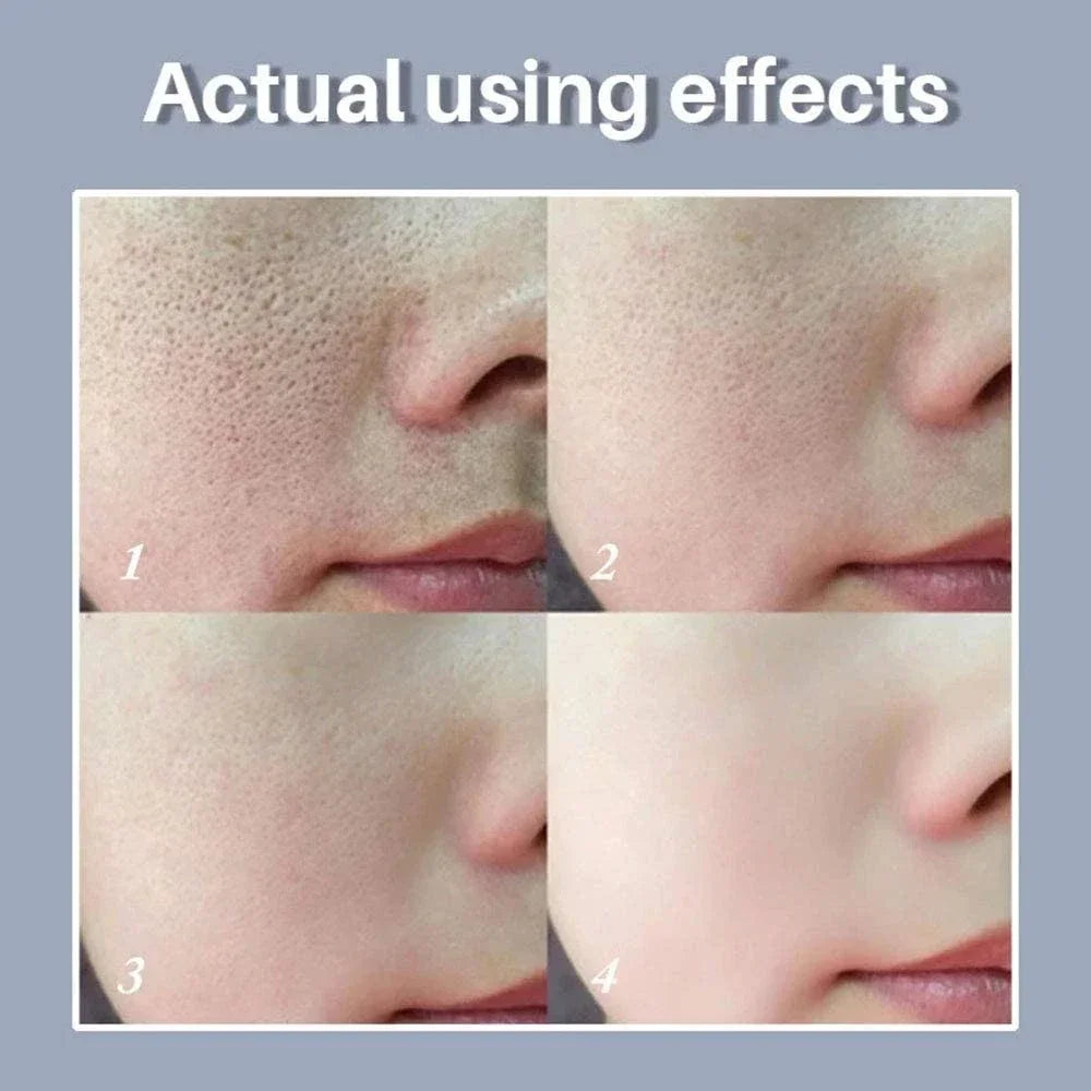 Skin Texture Pore Refining Resurfacing Brightening Facial Serum Retinol and Niacinamide Non-Comedogenic