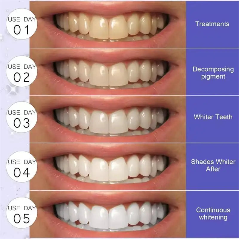 Purple Whitening Teeth Stickers 14 Pairs