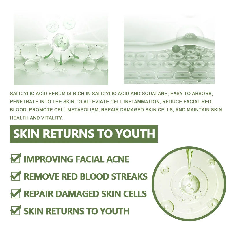 Anti-Acne Face Serum  Korean Skincare Products