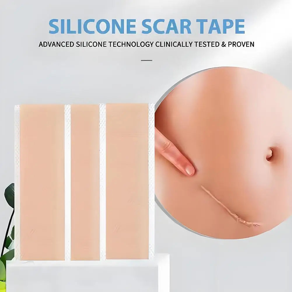 4X300CM Silicone Scar Patch Skin Repair Sheets Self-Adhesive Stretch Mark Tape Therapy Patch Burn Acne Scar  ﻿